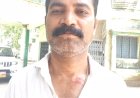 ପି ଏମ ଜନ ମନ ଯୋଜନା ଗୃହ  ସମ୍ପର୍କ ରେ ଆଲୋଚନା କରୁଥିବା ସମୟରେ ପଞ୍ଚାୟତ ନିର୍ବାହୀ ଅଧିକାରୀ ଙ୍କୁ ଆକ୍ରମଣ |